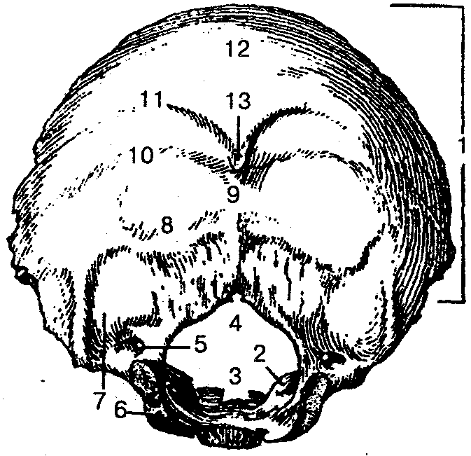 Мыщелок черепа. Затылочная кость черепа анатомия. Кости черепа затылочная кость. Чешуя затылочной кости анатомия. Затылочная кость аномалии.