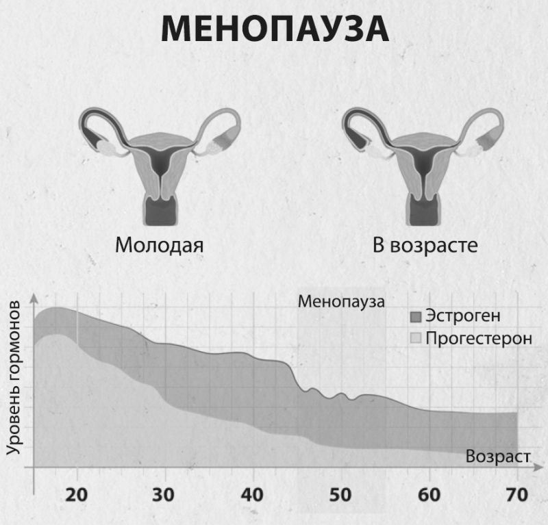 Яичники в пременопаузе. Размеры яичников в климаксе. Яичники в период менопаузы.