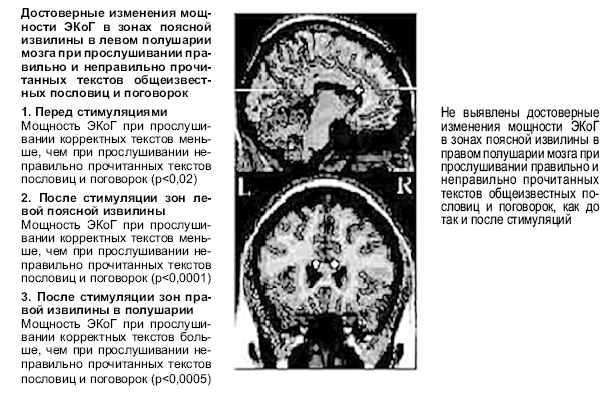 Головной мозг бехтерева. Здоровый и больной мозг человека Бехтерева. Мозг Бехтерева. Ошибки мозга книга.