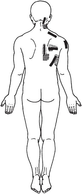 Лечебные точки организма: снимаем боли в суставах и мышцах, укрепляем кожу, вены, сон и иммунитет. Владимир Иванович Васичкин. Иллюстрация 72