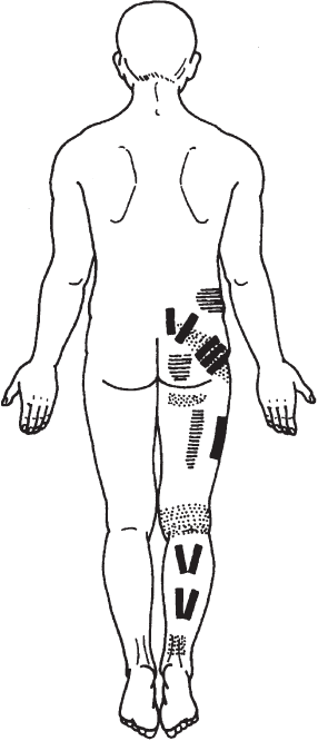 Лечебные точки организма: снимаем боли в суставах и мышцах, укрепляем кожу, вены, сон и иммунитет. Владимир Иванович Васичкин. Иллюстрация 78