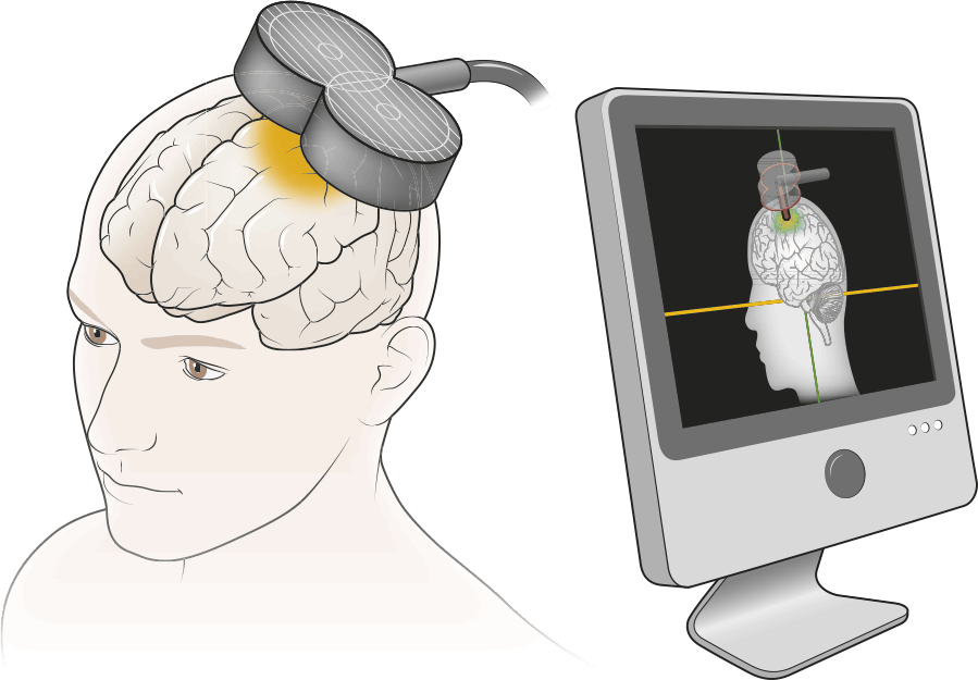 Как стимулировать мозг. Глубокая стимуляция мозга. Живой мозг Дэвид Иглмен. Иглмен мозг ваша личная история. Аудио стимуляция мозга.