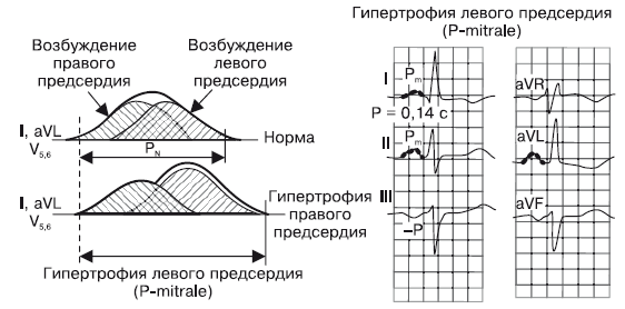 Что показывает кардиограмма. Оксана Владимировна Салова. Иллюстрация 17