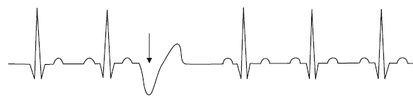 Что показывает кардиограмма. Оксана Владимировна Салова. Иллюстрация 49