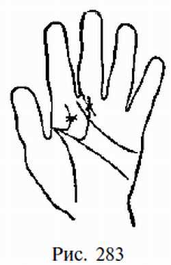 Законы научного чтения руки. Вильям Г Бенхем. Иллюстрация 245