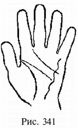 Законы научного чтения руки. Вильям Г Бенхем. Иллюстрация 309