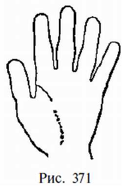 Законы научного чтения руки. Вильям Г Бенхем. Иллюстрация 343