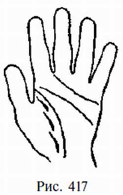 Законы научного чтения руки. Вильям Г Бенхем. Иллюстрация 393