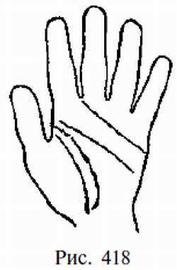 Законы научного чтения руки. Вильям Г Бенхем. Иллюстрация 394