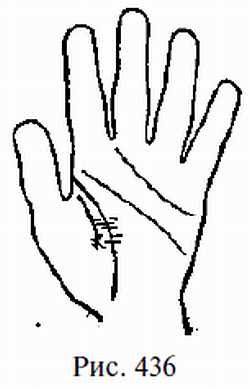 Законы научного чтения руки. Вильям Г Бенхем. Иллюстрация 414