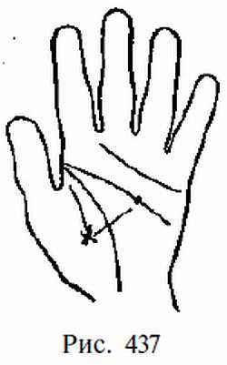 Законы научного чтения руки. Вильям Г Бенхем. Иллюстрация 415