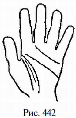 Законы научного чтения руки. Вильям Г Бенхем. Иллюстрация 422